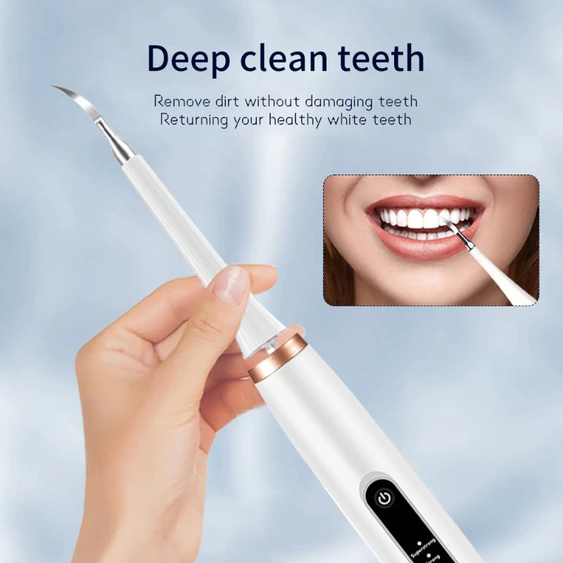 ZooFlex Ultrasonic Pet Dental Cleaner for Dogs & Cats – Electric Plaque Remover